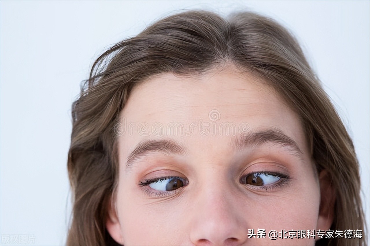 斜视怎么自我矫正视频,成人外斜视自我矫正训练图