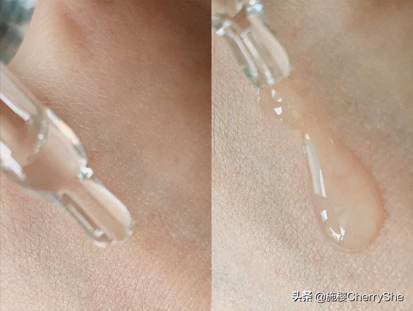 早c晚a用了之后皮肤变黄,早c晚a用完之后脸黑