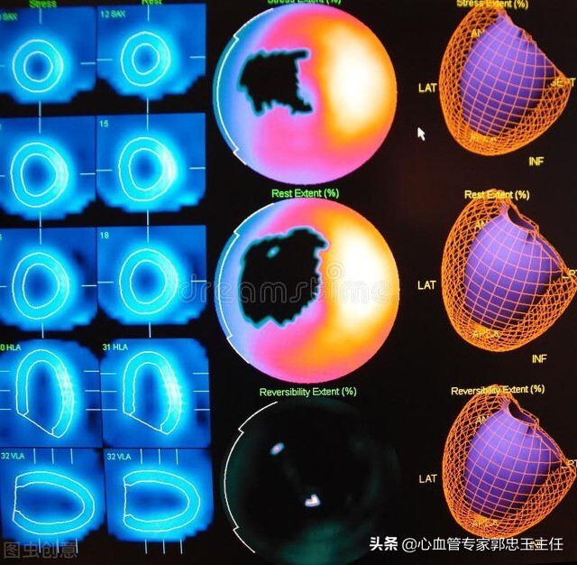 彩超心脏检查能查到心包疾病吗,心脏彩超检查哪些疾病