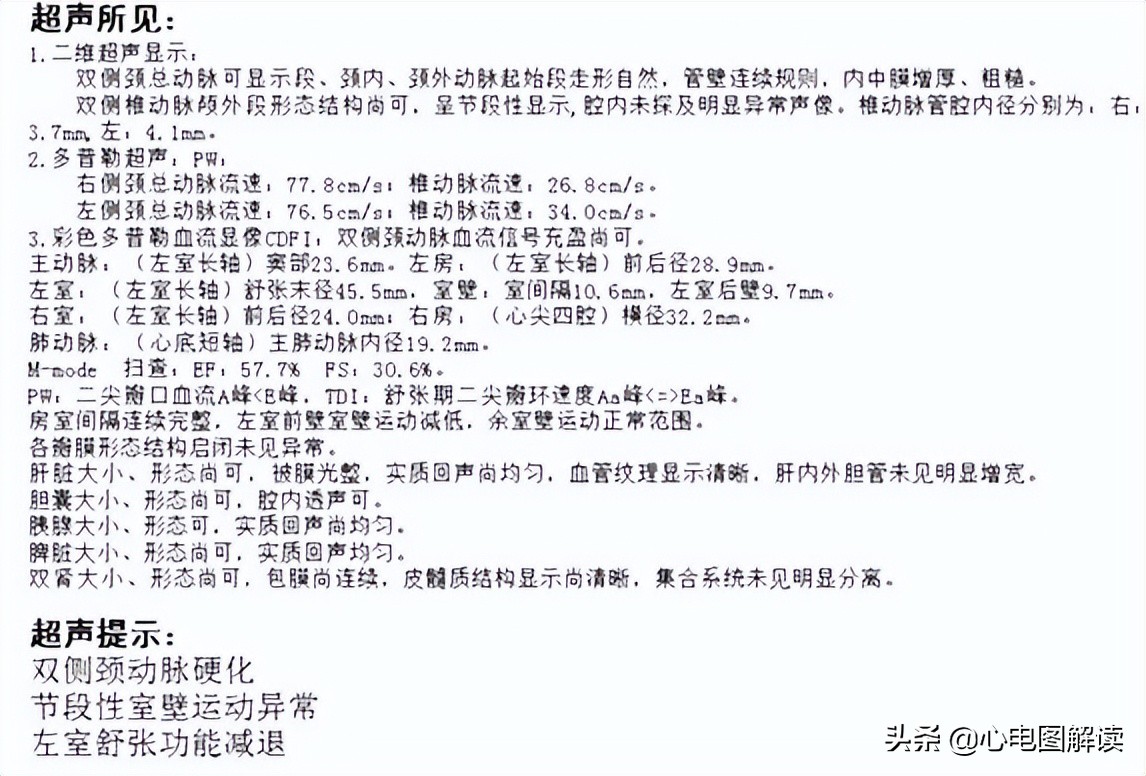 阵发性房性早搏是怎么引起的,房性早搏比阵发性房颤难治吗
