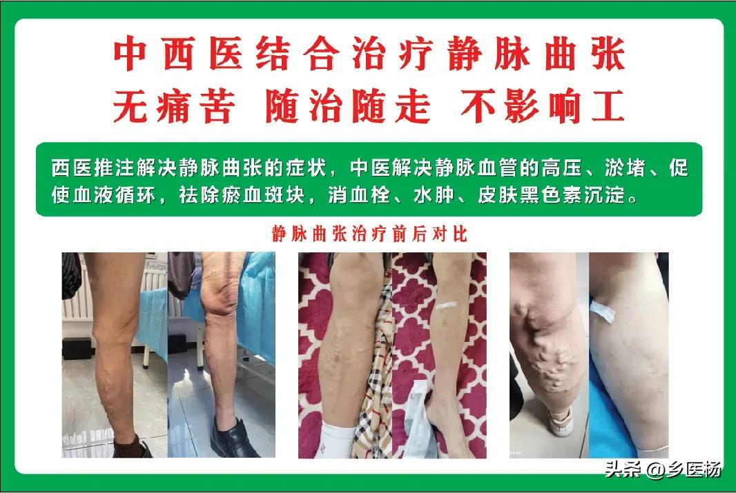 济南乡医杨涛电话,过敏性鼻炎如何调理肺脾肾功能