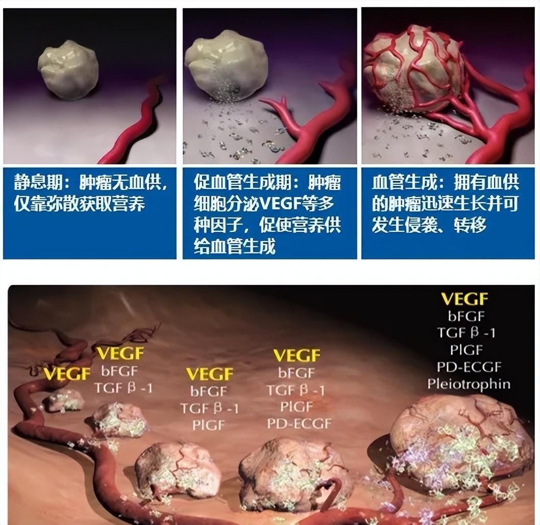 抗血管生成药一览表,抗血管生成药物作用机制