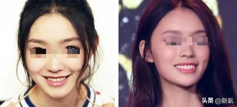 盘点各大女明星笑容合集,笑起来眼睛也会笑的女明星