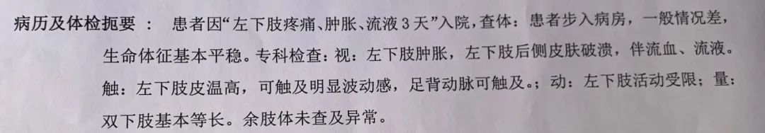 骨头坏死重疾险不赔,表皮坏死松解症重疾险能赔吗