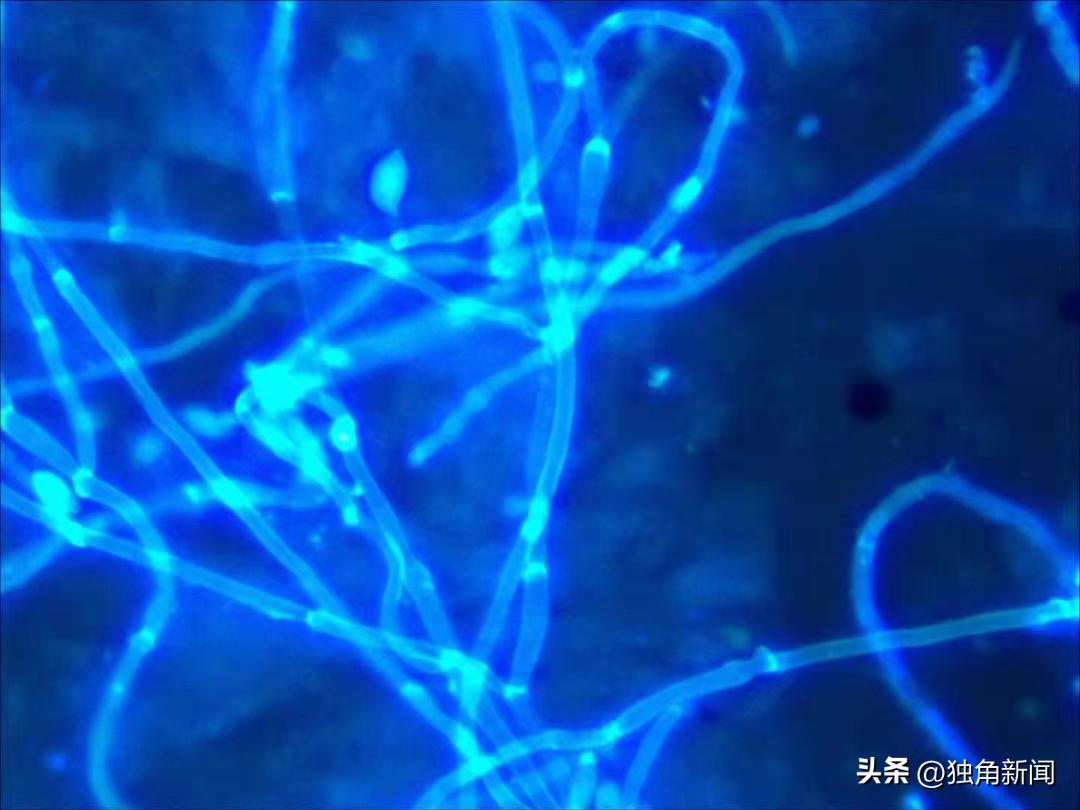 “吸猫撸狗”一时爽，小心皮肤“闹脾气”