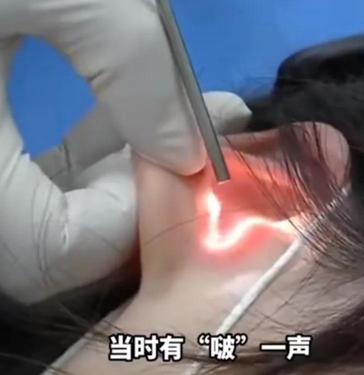 男朋友亲女朋友致耳膜穿孔,情侣亲吻导致耳膜穿孔