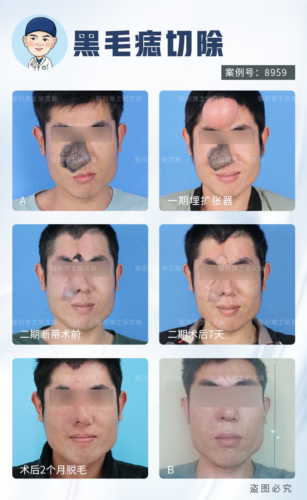 嘴巴缺了一小块肉多久能好,嘴巴好像缺了一块肉怎么回事