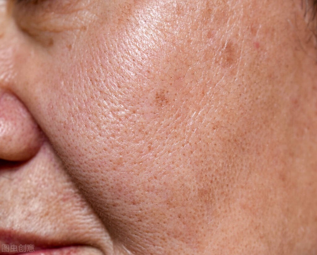 油皮毛孔粗大护肤套装推荐,油皮毛孔粗大妆前护肤步骤