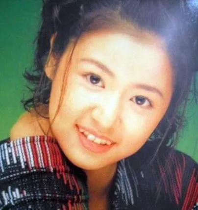 明明是绝顶大美女，却被牙齿拉胯，这15位女星苦不堪言