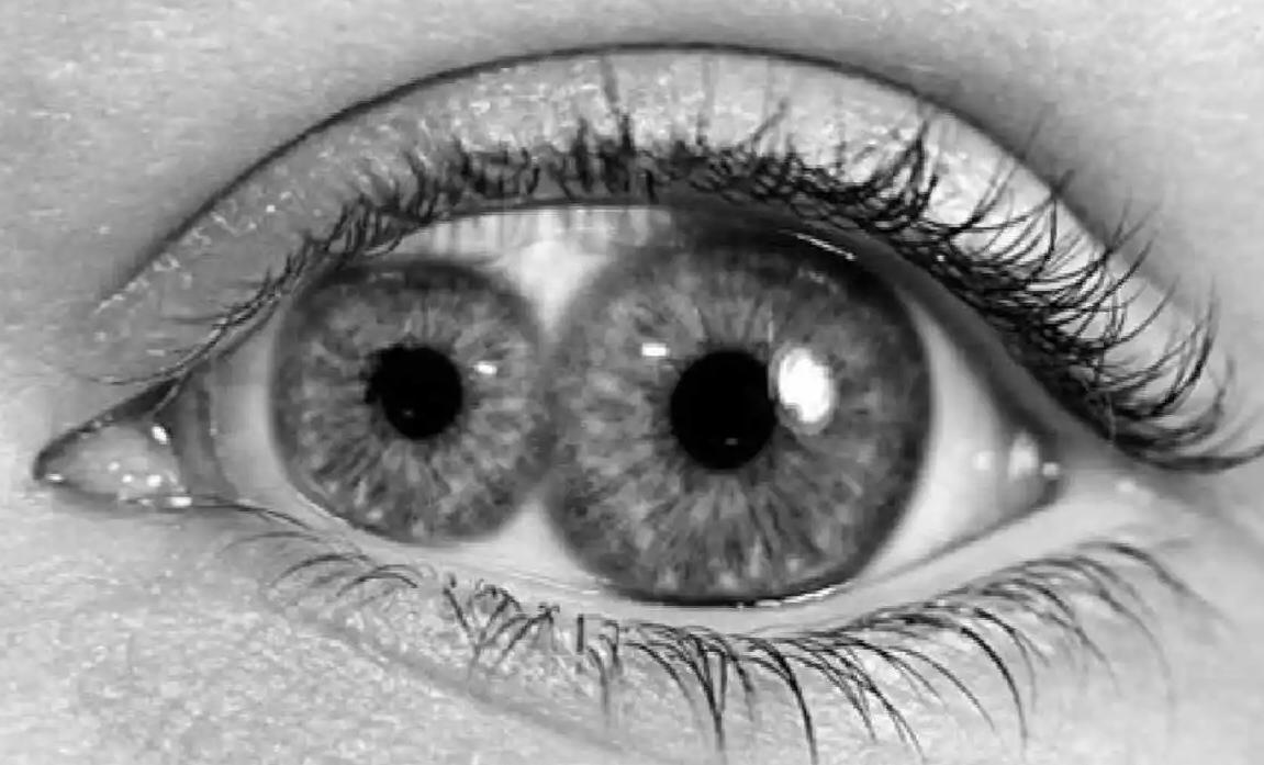 历史上有双瞳眼的人,什么是双瞳孔图片