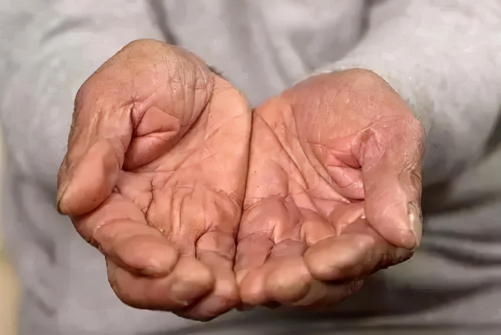 寒湿体质吃凉的就便秘,虚寒便秘和气虚便秘