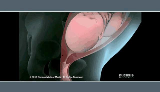 生孩子剖腹产与顺产对比,生孩子顺产和剖腹产对比