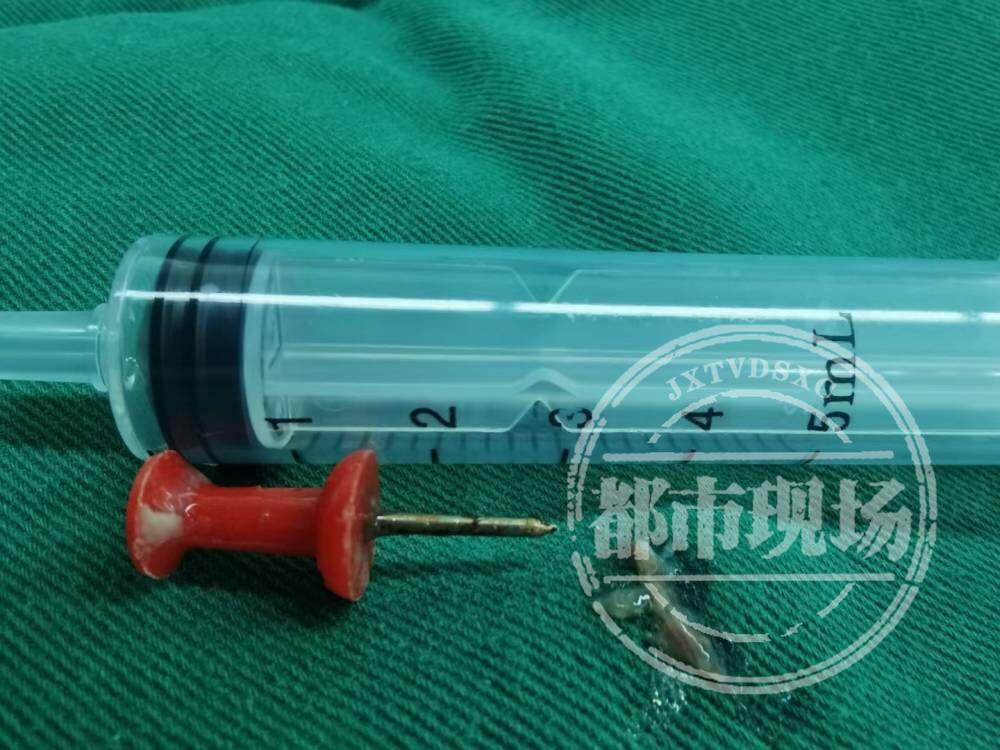 孩子误吞图钉怎么办,八岁男孩误吞图钉