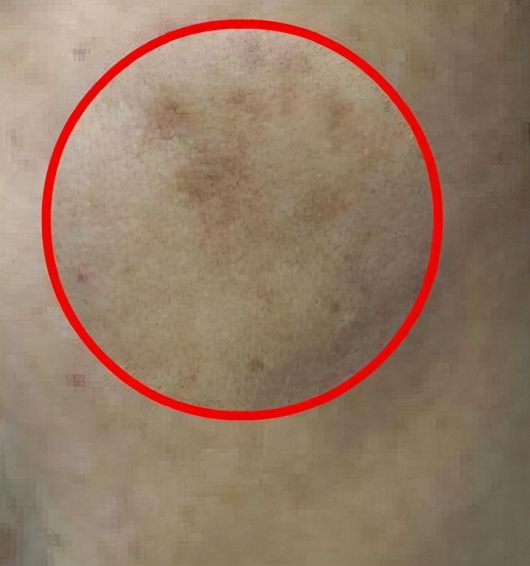 中医祛斑美白的最快方法,牙膏白醋祛斑美白方法