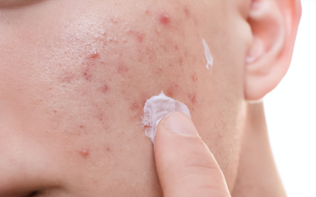 有些女性下身无毛是怎么回事?这4个原因,为了健康,最好了解