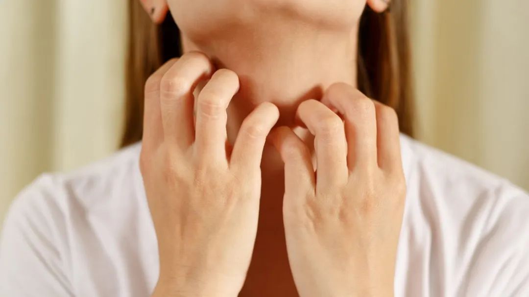 过敏反反复复吃药也没用怎么办,过敏体质反反复复的过敏该怎么办