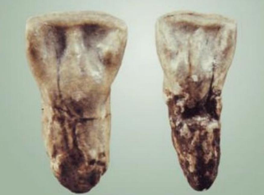 华夏子孙的3个印记:门牙、褶子和脚趾,与生俱来且无法抹去