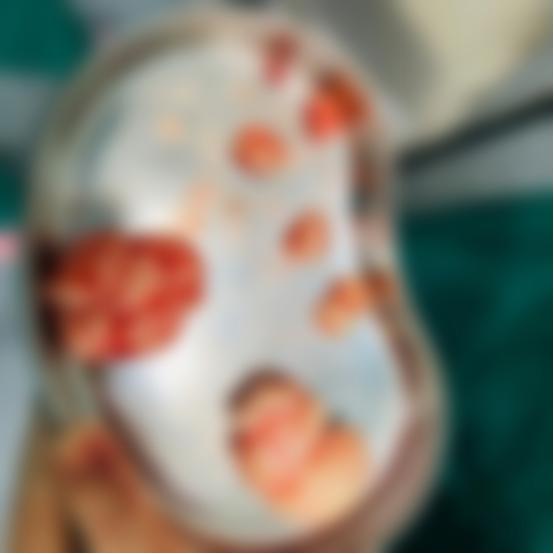 贫血有可能是胃出现问题吗,贫血会是什么肿瘤引起的