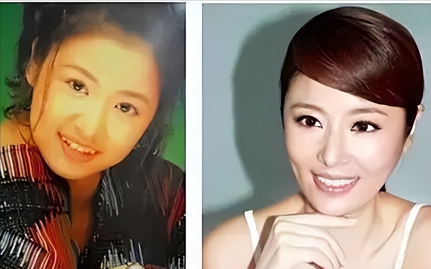 明星的牙都很齐吗,明星的牙齿都很好看