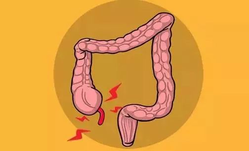 剧烈运动会得盲肠炎吗,饭后一小时剧烈运动会得盲肠炎吗