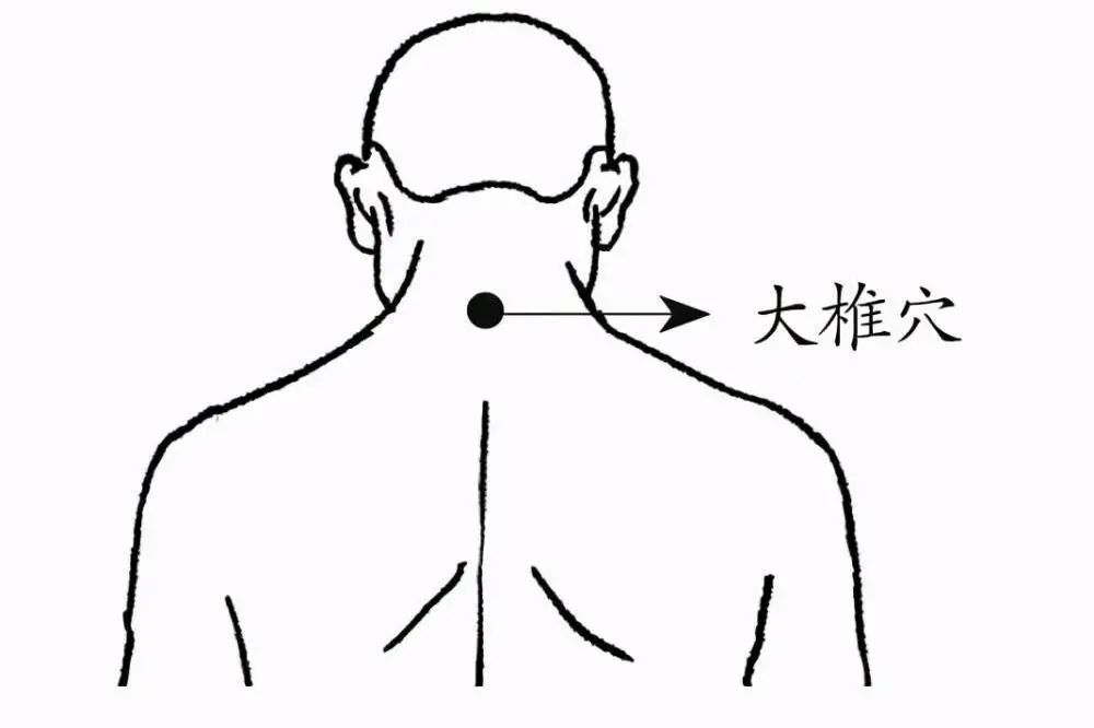 阳了偏头痛的最佳解决办法,头为六阳之首是什么意思