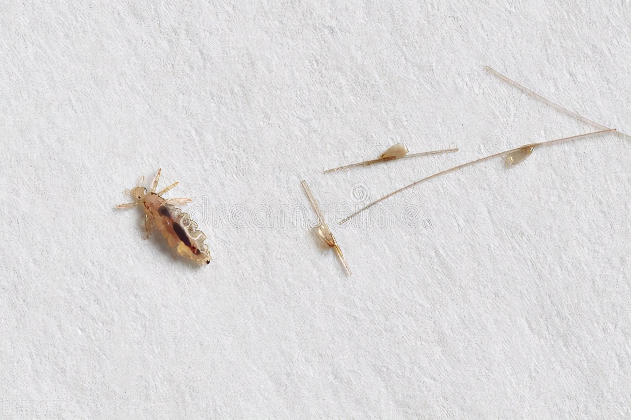 女性阴虱瘙痒用什么药,女性瘙痒有白色的蛲虫