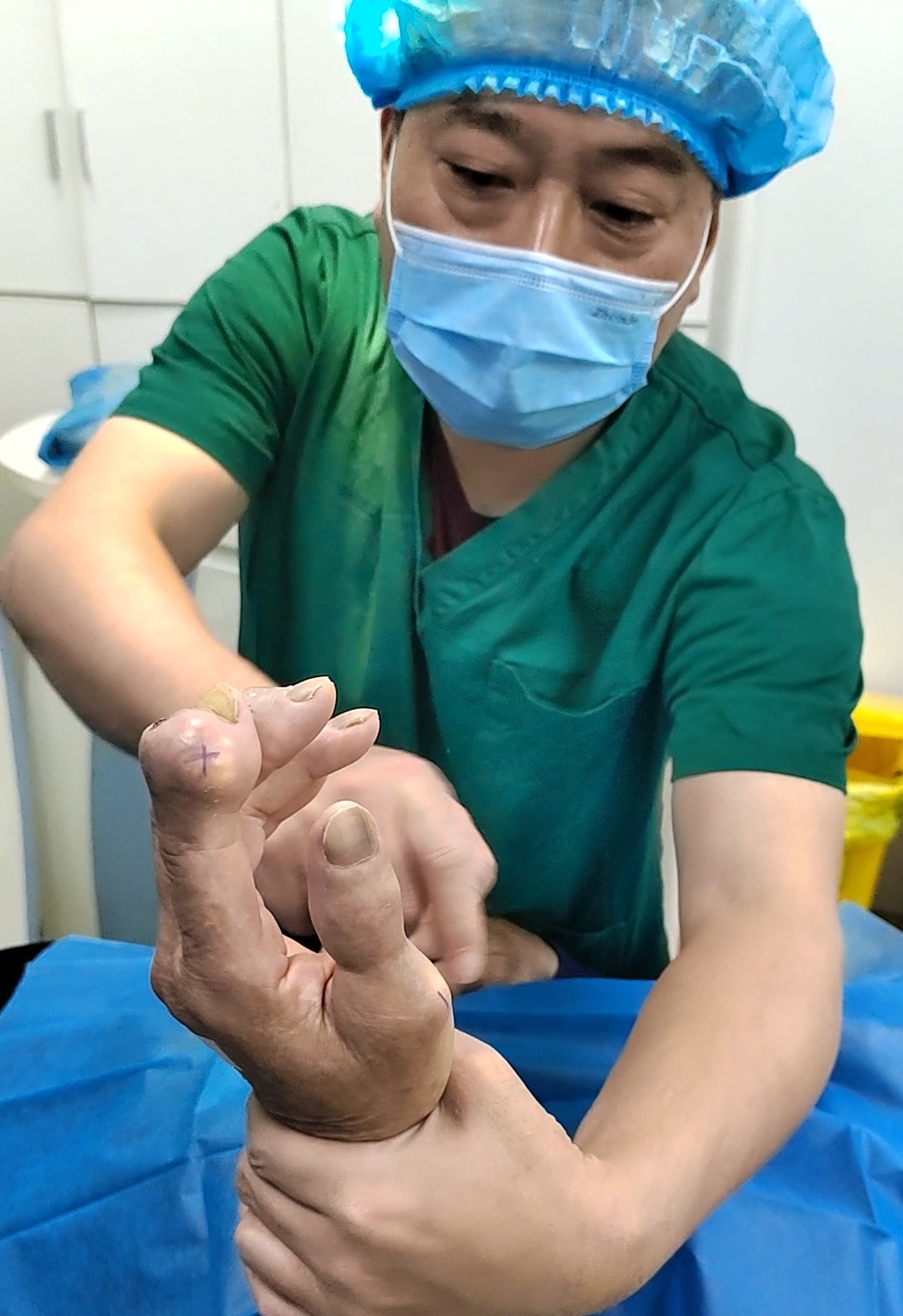 重庆市痛风专家高锋,高锋医生