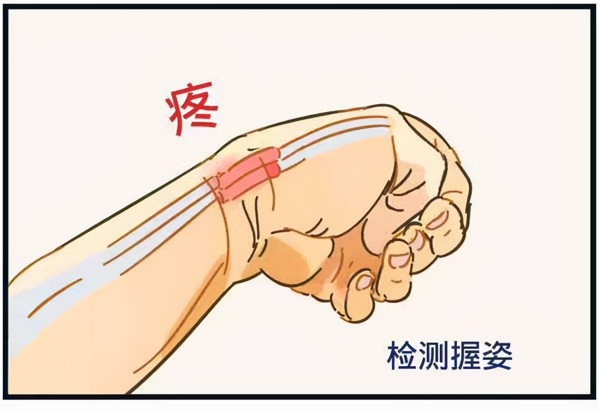 青岛老中医治疗腱鞘炎,长沙治疗腱鞘炎比较厉害的中医