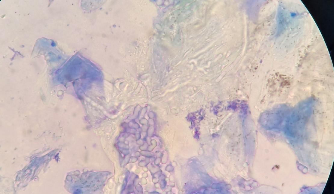 猫咪得了猫癣怎么治疗好得快一些,猫咪得了很严重的猫癣怎么办