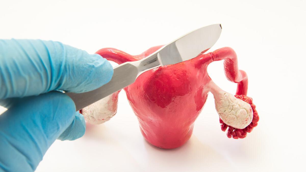 绝经后切除子宫对身体有什么影响,子宫脱垂切除子宫对身体有影响吗