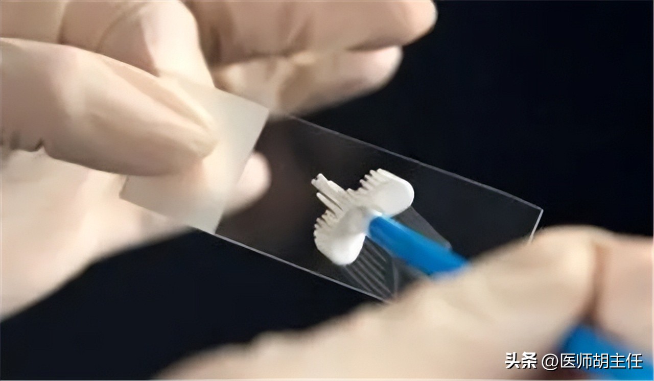 宫颈癌的前兆会不会腿痛,宫颈癌有一项异常会怎样