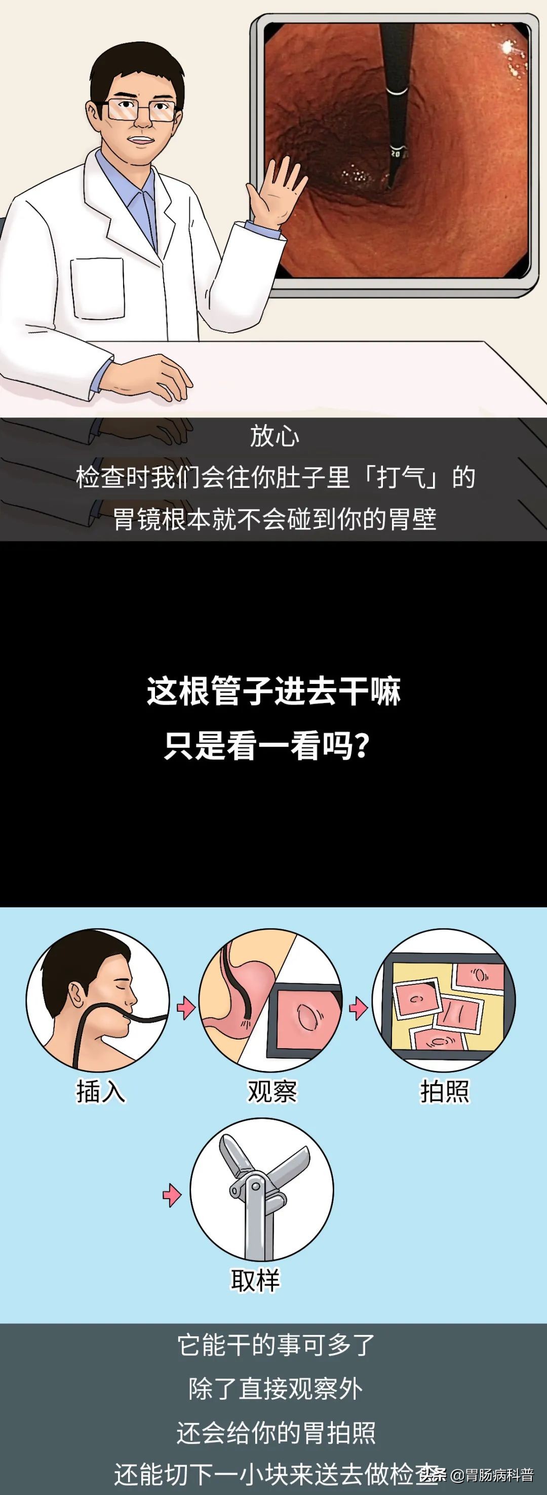 图说胃病,胃镜怎么做的全过程示意图