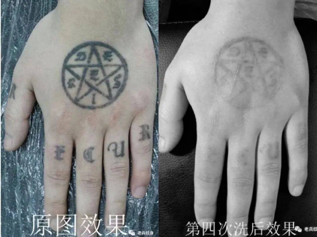 怎样洗纹身对皮肤的损伤小,不伤皮肤的洗纹身方法