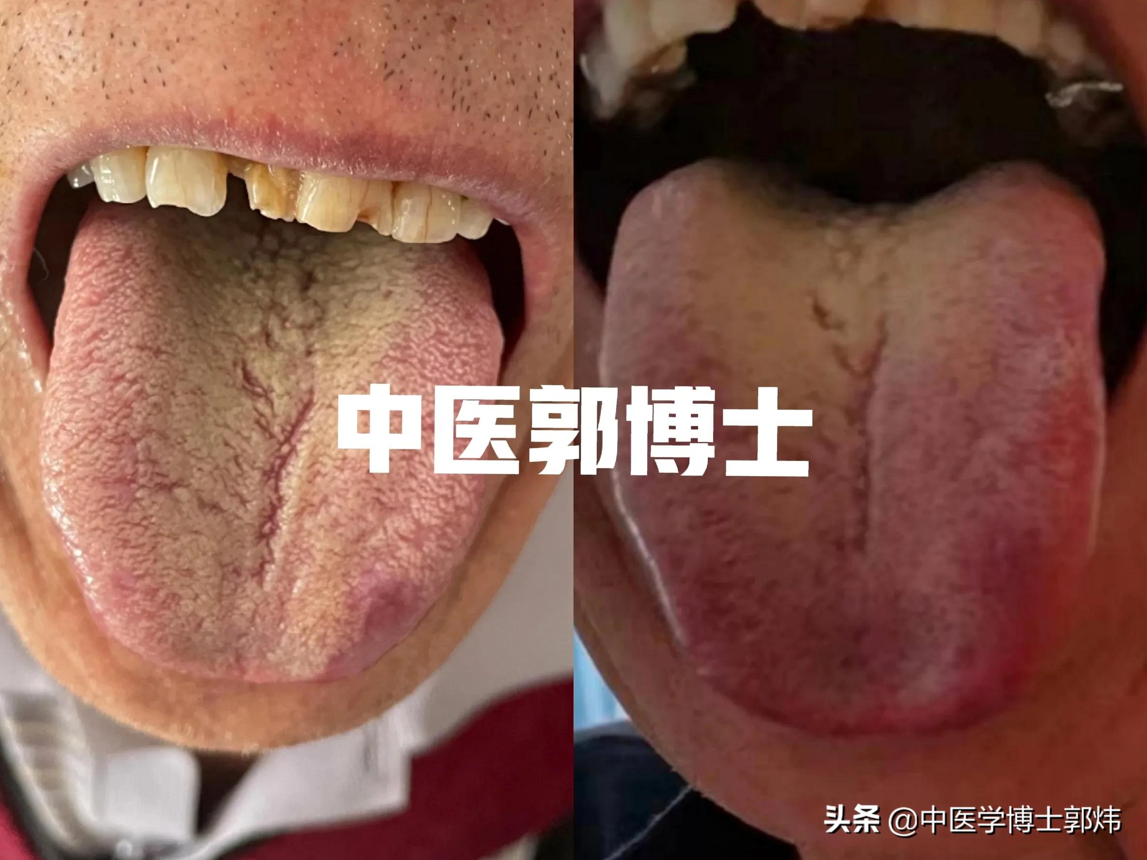 长期胃胀气中医,胃胀气6年了吃很多药都没有效果