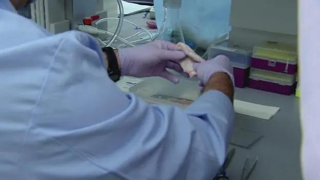 吃了猪尿泡,万事皆simple