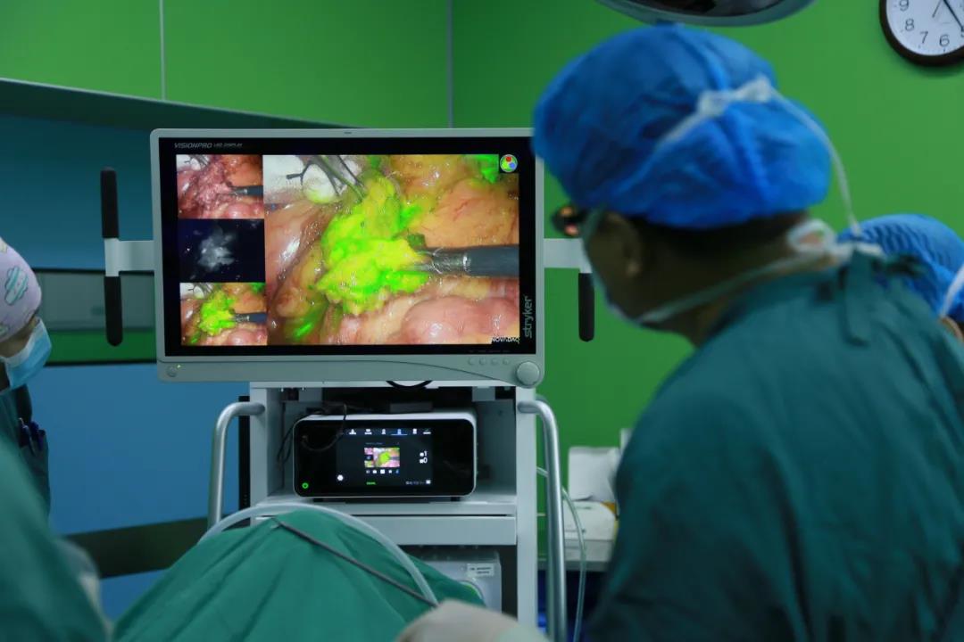 单孔腹腔镜不适合哪些妇科手术,妇科单孔腹腔镜