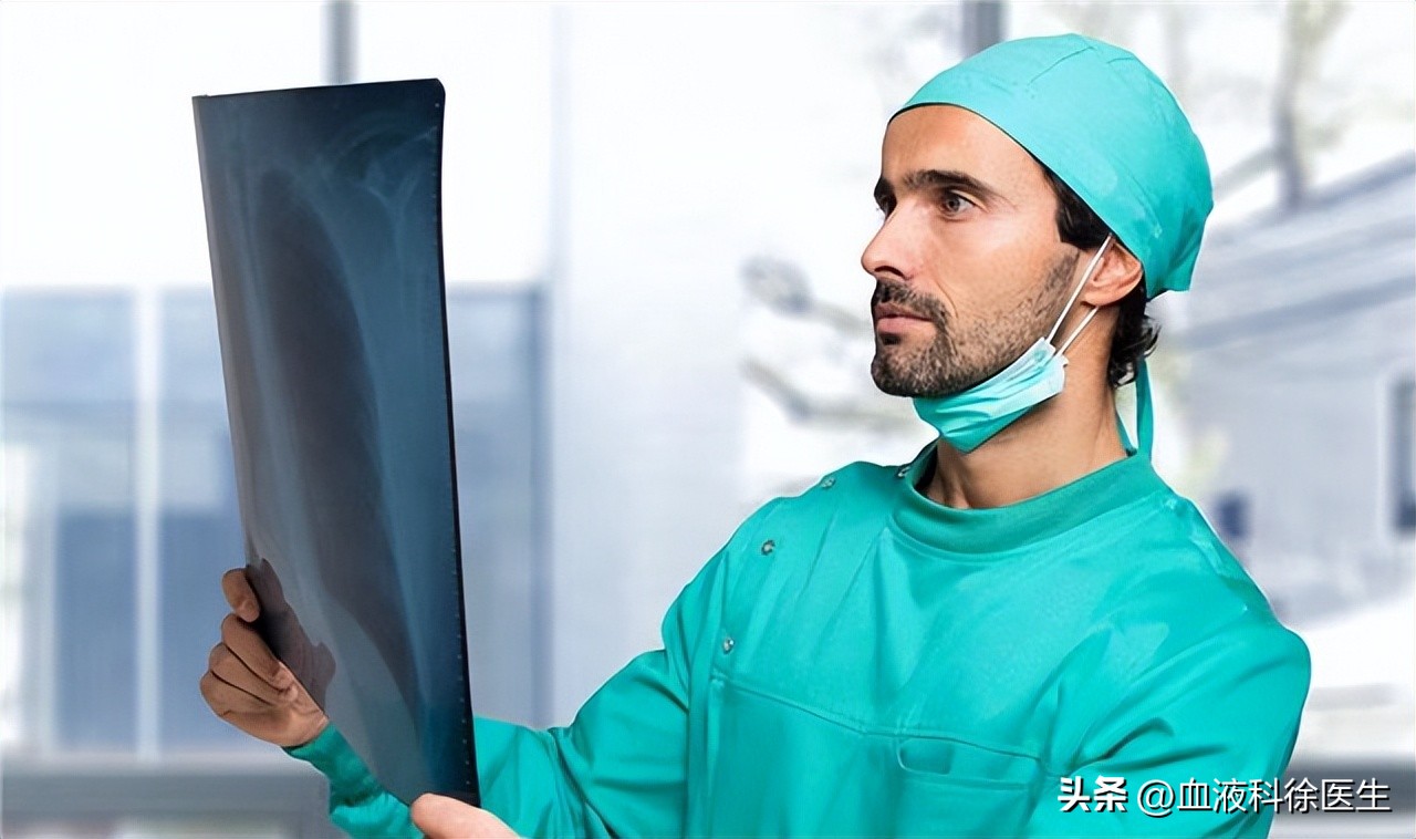 得了胰腺癌真的无药可救了吗,如果得了胰腺癌还能活多久