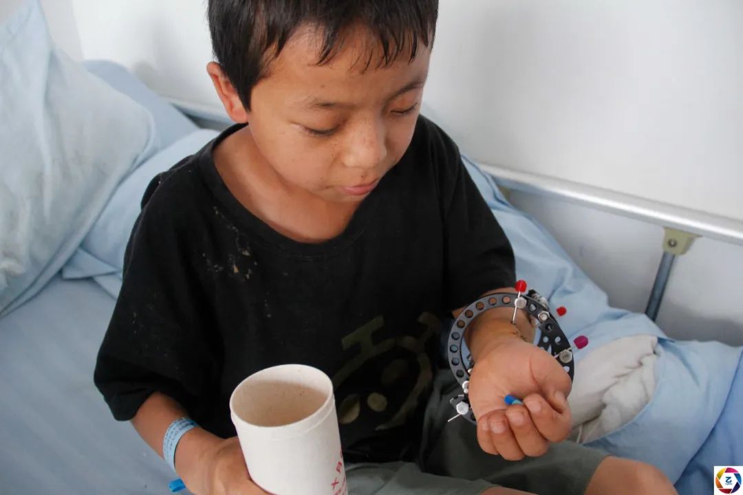 男子被石头砸伤怎么办,小男孩被石头砸到后续