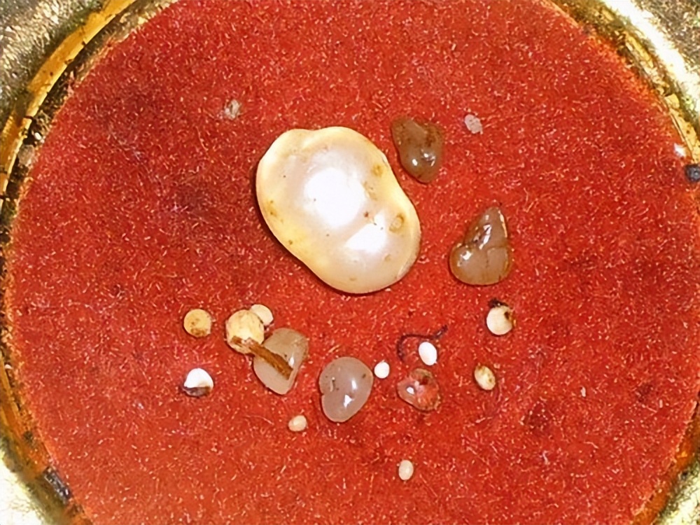 从科学的角度来解释舍利子,舍利子形成的五大原理推测