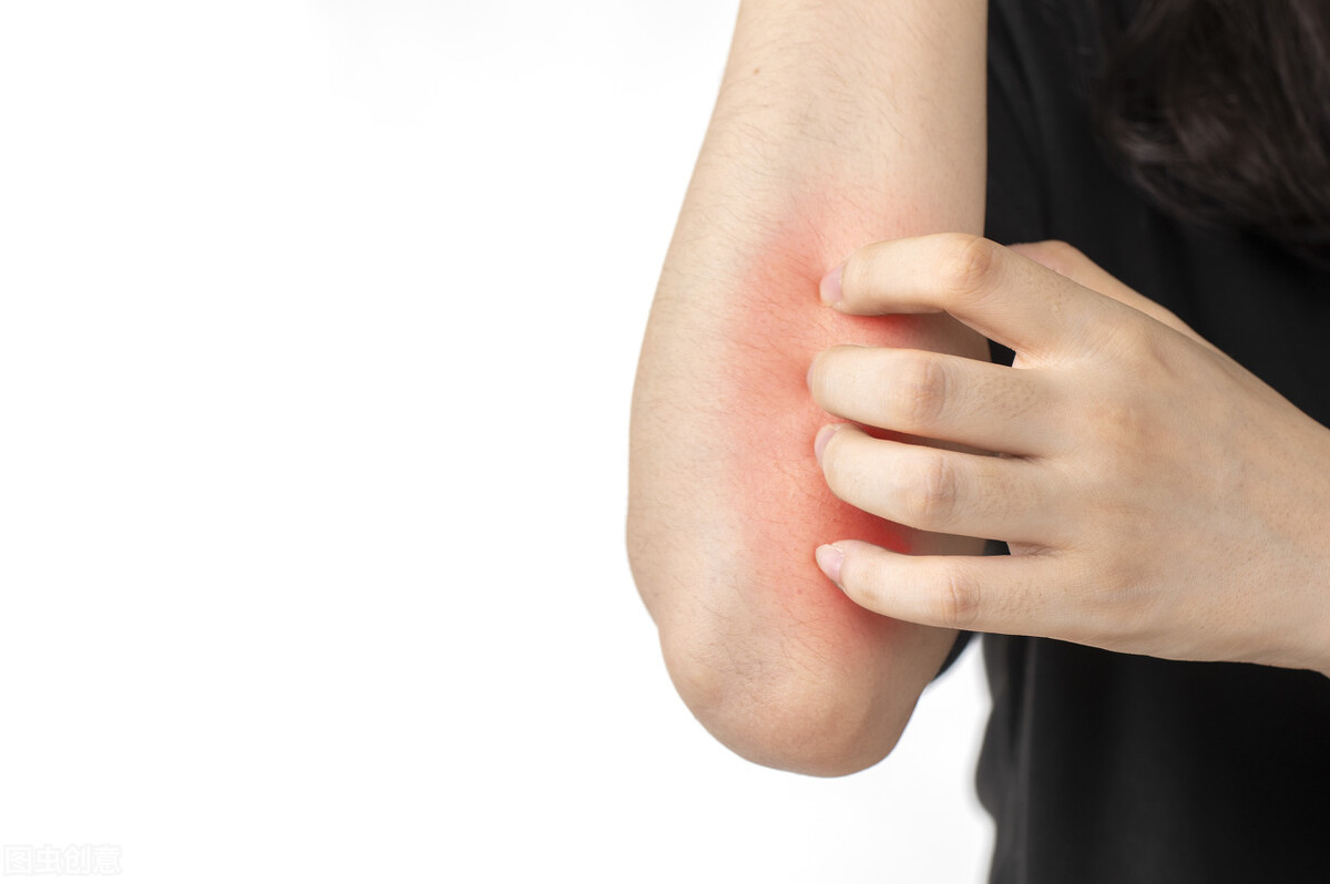 老年*皮人**肤总是瘙痒千万别乱挠，做好这几点，能够有效缓解