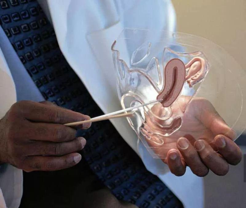 做完手术后“零”疤痕！帮你解除病痛的同时美丽不打折