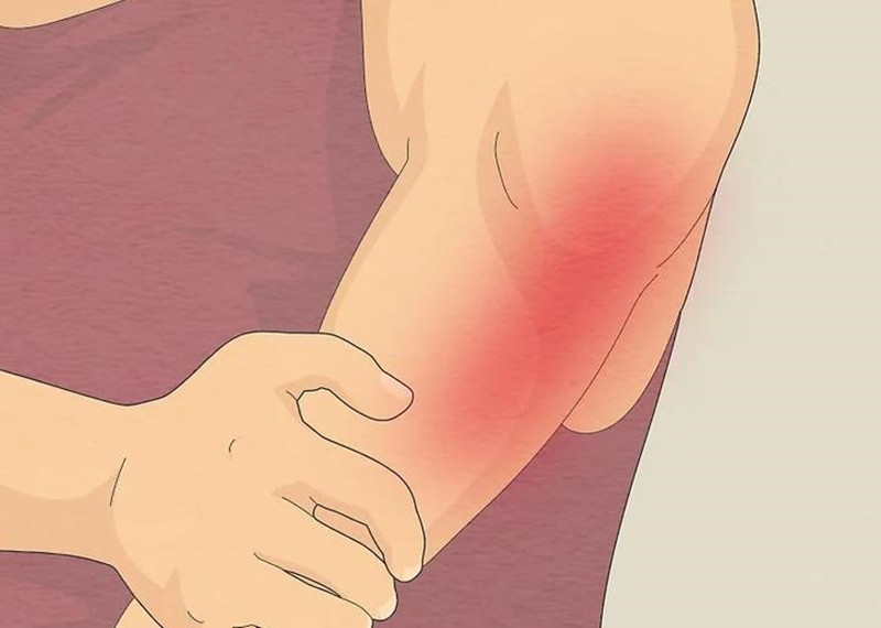 宸﹁兂鑶婄柤鐥涢绀虹潃涓夌鐤剧梾,宸﹁兂鑶婂悗鑳岀柤鐥涜鎯曚笁绉嶇梾