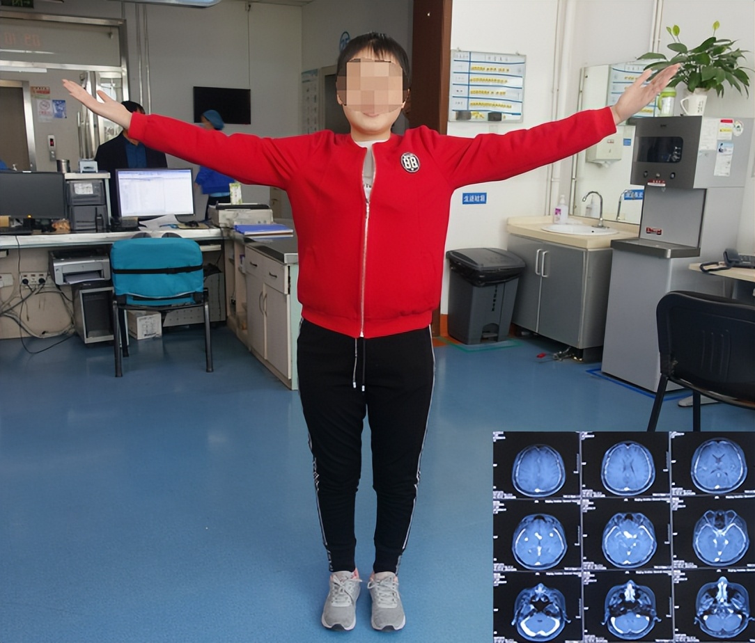 结核脑炎型脑积水怎么治,结核性脑膜炎2期很严重吗