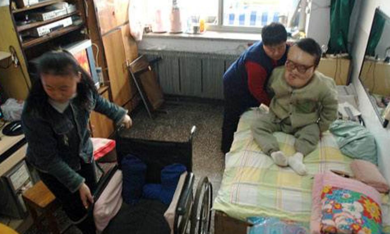 男孩得了怪病头部巨大,男孩得了怪病只有半个头