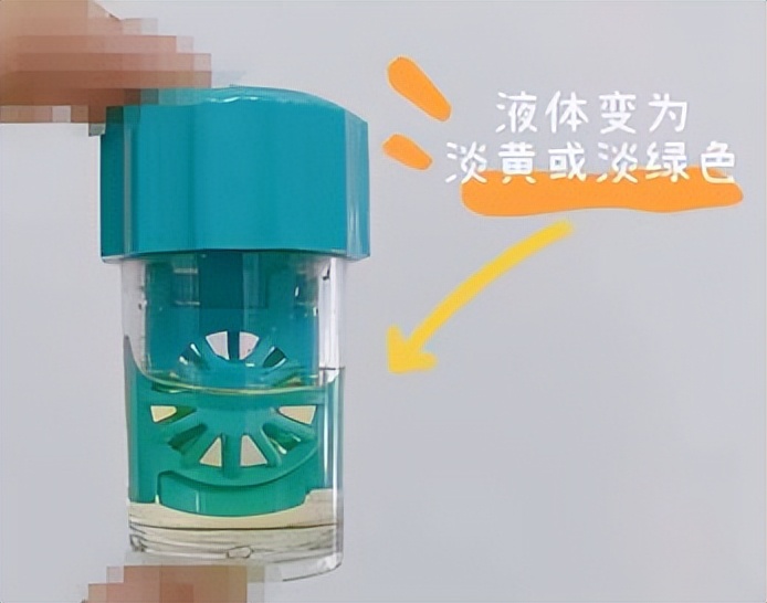 用双氧水清洗角膜塑形镜眼睛充血,双氧水清洗角膜塑形镜
