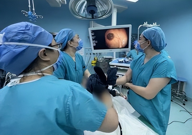 蓝色橡皮泡痣综合征病因,蓝色橡皮疱样痣综合征超声表现