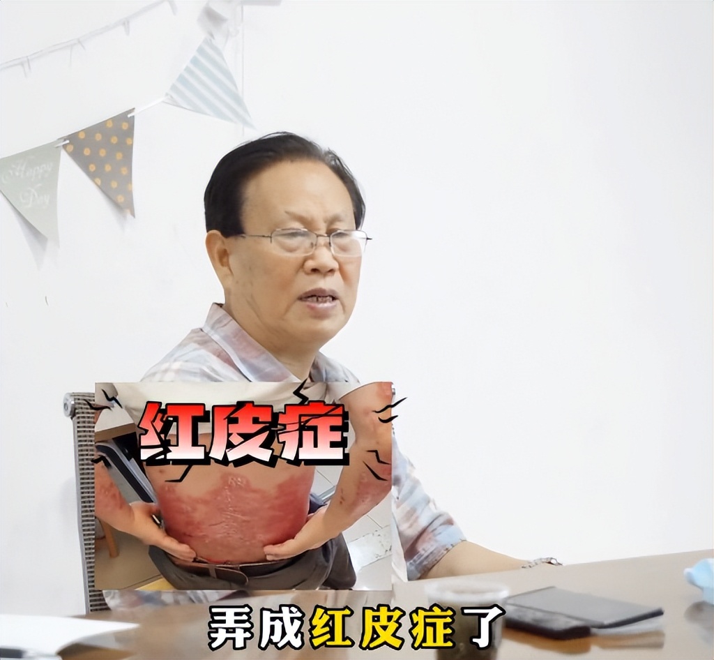 公路领导红皮型银屑病拒绝住院，何教授迎难而上：治就治