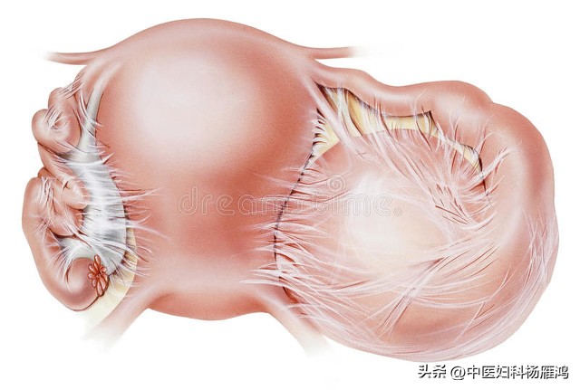 输卵管堵塞怎么治最快最有效,输卵管堵塞怎么治疗最快最有效