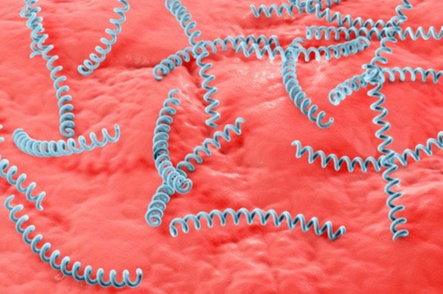 通过性传播的病有哪些不能治愈,8大性传播疾病可自测出来吗