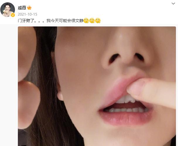 吴宣仪大龅牙,吴宣仪牙不修复吗